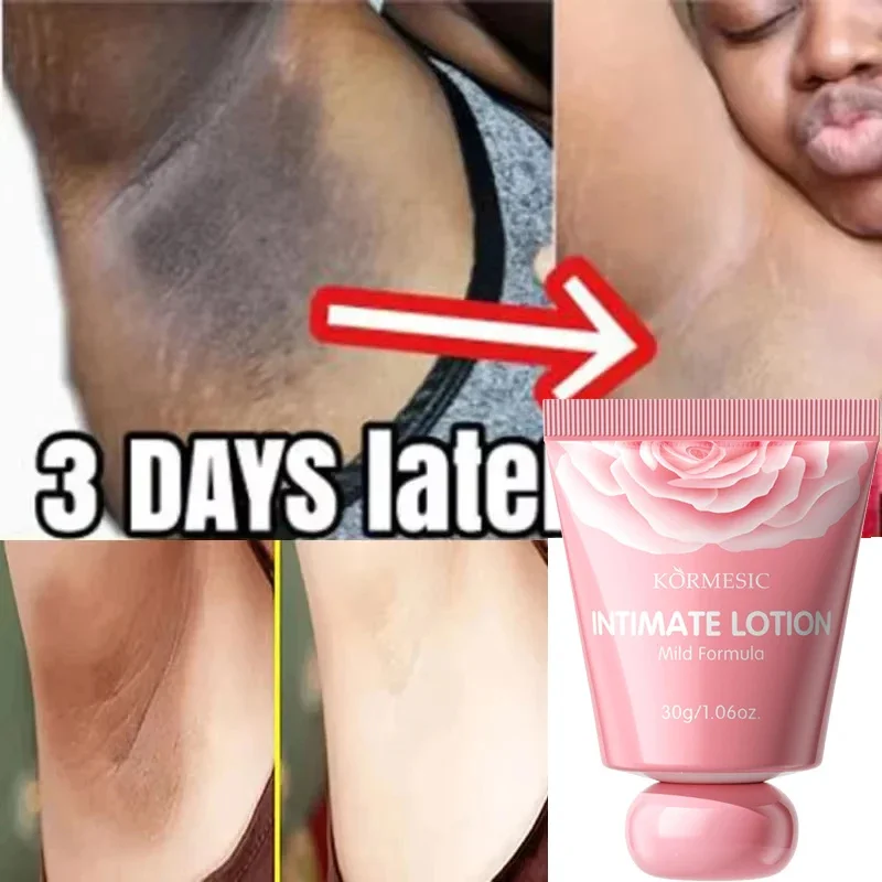 كريم تبييض الجسم تحت الإبط أجزاء خاصة مصل تبييض بعقب الركبة سطع الفخذ الداخلي الميلانين الحميم العناية بإزالة الداكن #2