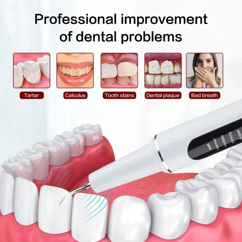 Xiaomi Youpin Ultrasonic Dental Scaler 2.8M/min High Frequency Vibrating Teeth Cleaner Plaque Calculus Tartar Stains Remover