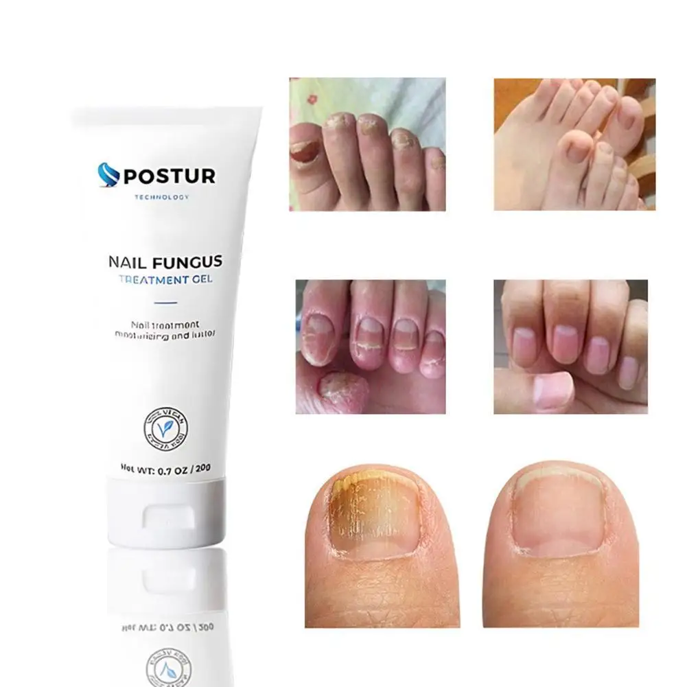 

Гель для ухода за ногтями Гель-лак для ногтей серый лак для ногтей ремонт ногтей гель Уход за ногтями защита ногтей