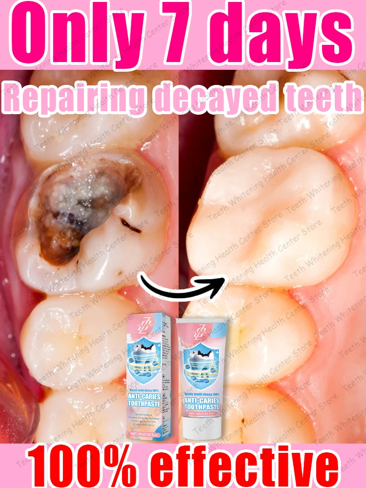 Repairing decayed teeth