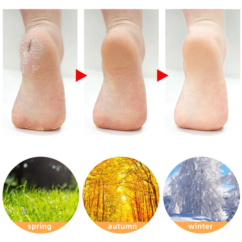 1 pasang kaus kaki Gel silikon perawatan kulit kaki SEBS kaus kaki Gel silikon melembapkan pelindung pengelupasan Anti retak