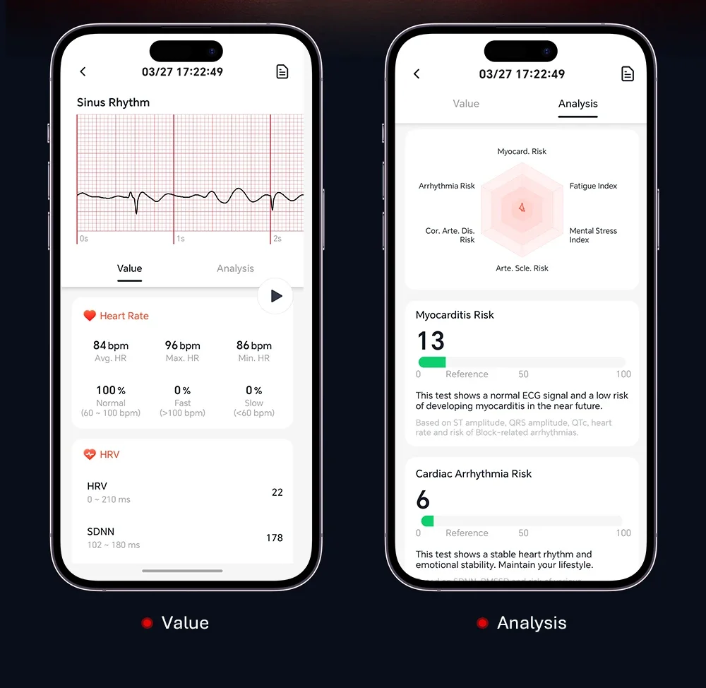 2026 NEUES VWAR LOOP V Smart Band Fitness-Tracker 24/7 EKG&HRV Schlaf-Blutsauerstoff-Körpertemperatur-Überwachung Fitness-Tracker-Band – Detail 4