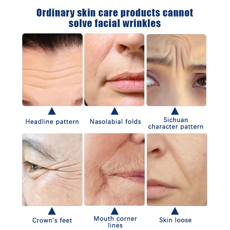 แผ่นปิดตาซิลิโคน 1 คู่เหมาะสำหรับรอยคล้ำและอาการบวม หน้ากากเจลเย็นสำหรับผู้หญิงแบบใช้ซ้ำได้