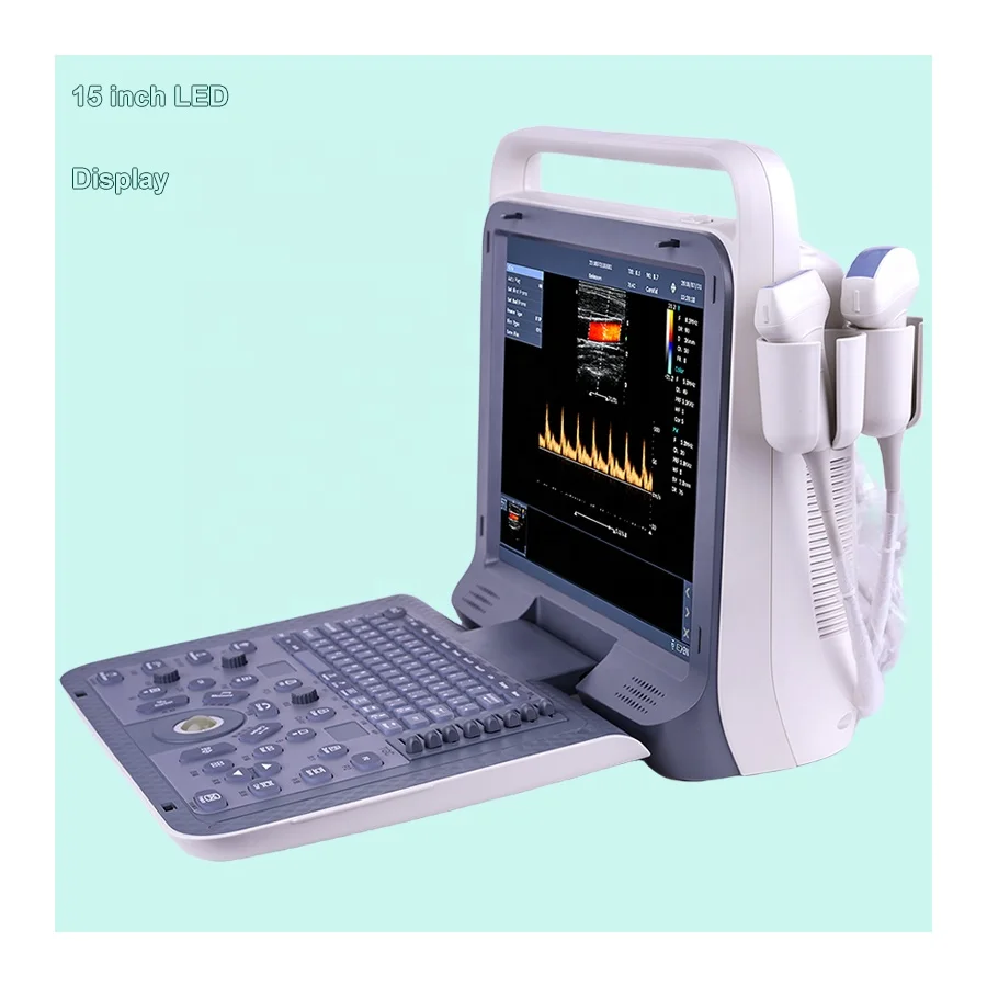Equipo médico portátil P60, sistema de ultrasonido, Doppler Color completamente digital, Diagnóstico, Doppler Color Fetal