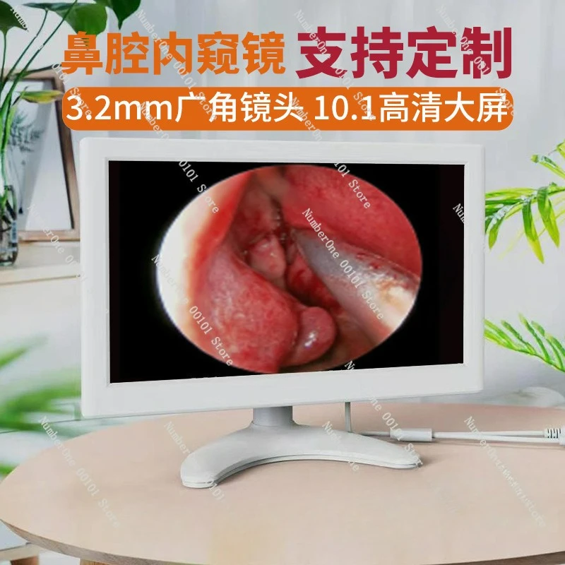 

Встроенный 10-дюймовый дисплей 3,9 мм видеоушной совок с экраном ЛОР-эндоскоп для полости рта