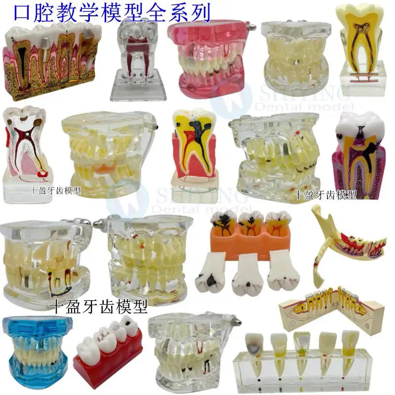 Dental Oral Teaching Model Caries Development Demonstration Crystal Adult Pathological Model Dental Anatomy Display