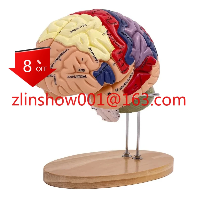 2 Times Magnification 4 Parts Brain Attached Cerebral Artery Model Cerebrovascular Model Neurology Human Brain Anatomy Model