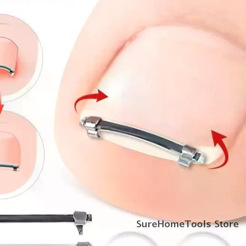 陥入爪矯正クリップ プロ仕様の湾曲したクランプ ペディキュアツール 陥入爪ケア＆埋没爪矯正用