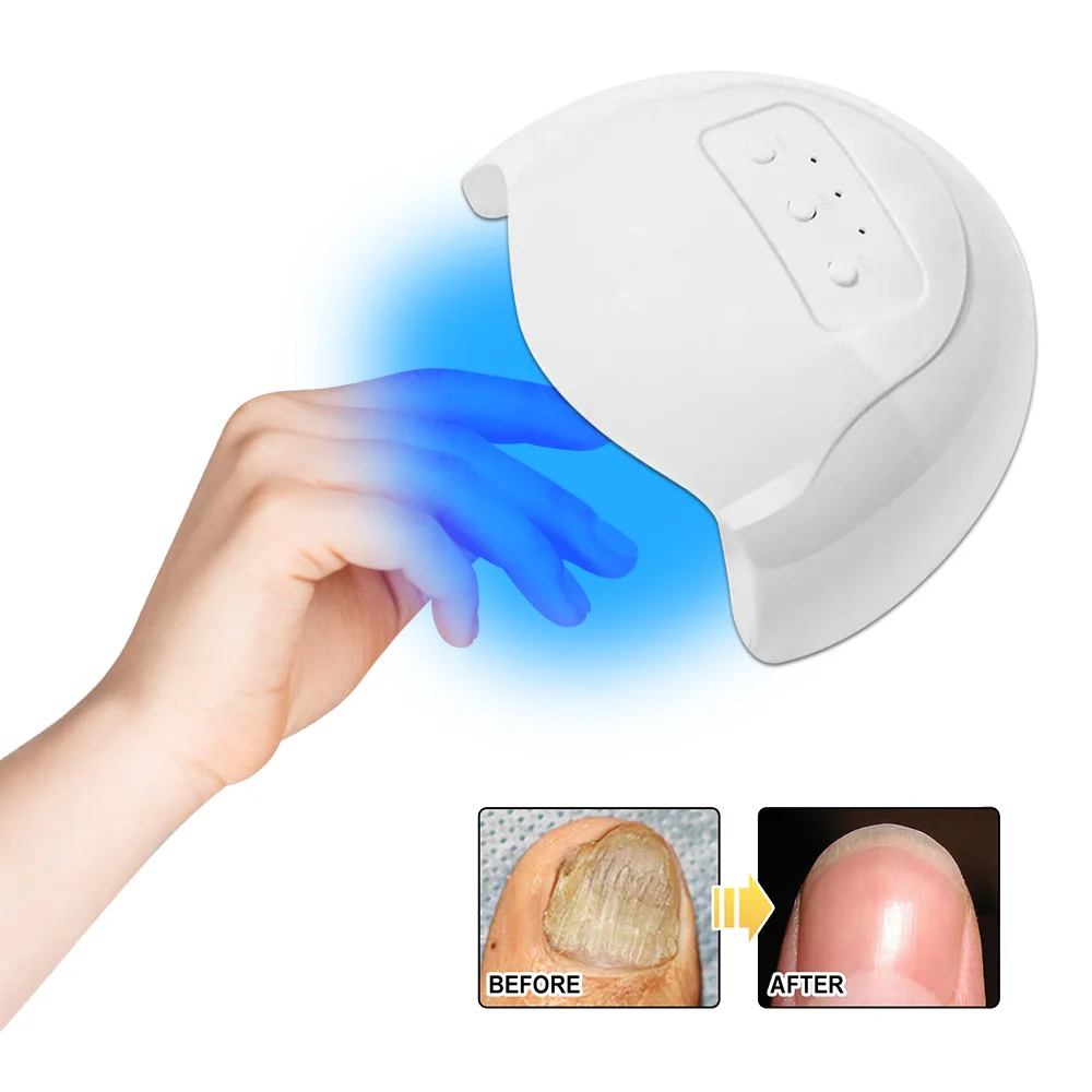 Toe Finger Nail Fungus Remover Nail Fungus Cleaning Laser Device Onychomycosis  Repair Damaged Discolored Thick Fingernails