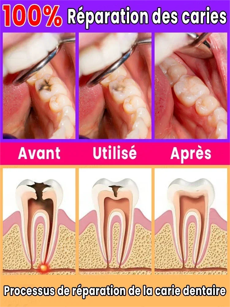 Дать тебя здоровый зуб