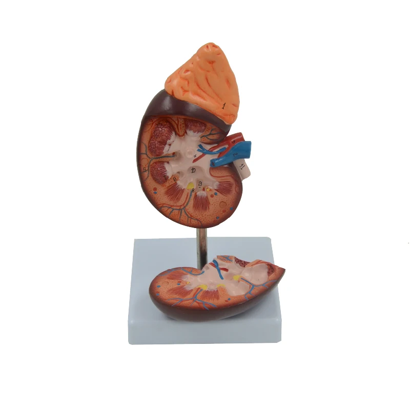 

Enlarged Kidney Anatomical Model Cortex Medulla Pyramids Calyces Renal Pelvis Urinary System Anatomy Educational Equipment Tool