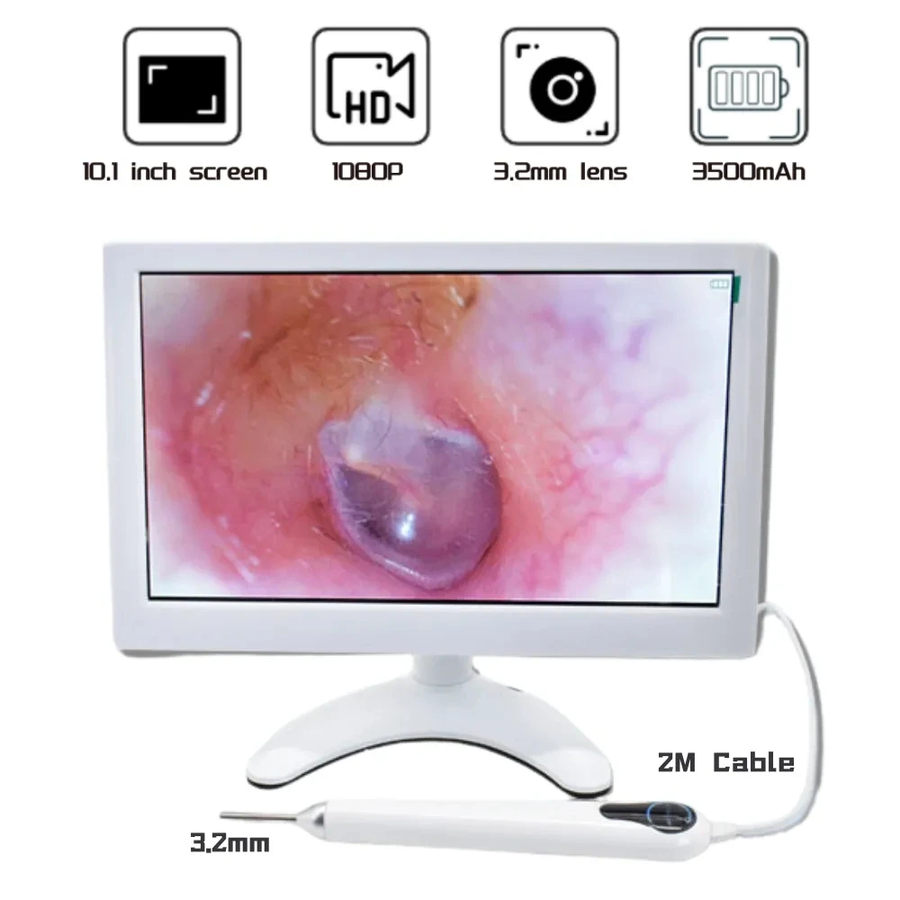 3.2mm 1080P HD Ear Scope ENT Endoscope 10.1 Inch Screen Digital Otoscope  Ear Cleaner Otoscope for Nose Hair Skin Inspection Pet