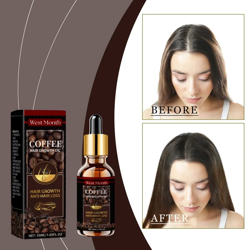 

Caffeine Anti-Hair Fall Hair Oil - Nourish Repair Dry Frizzy Hair Strengthen Roots Boost Growth Density Shine Smooth Scalp