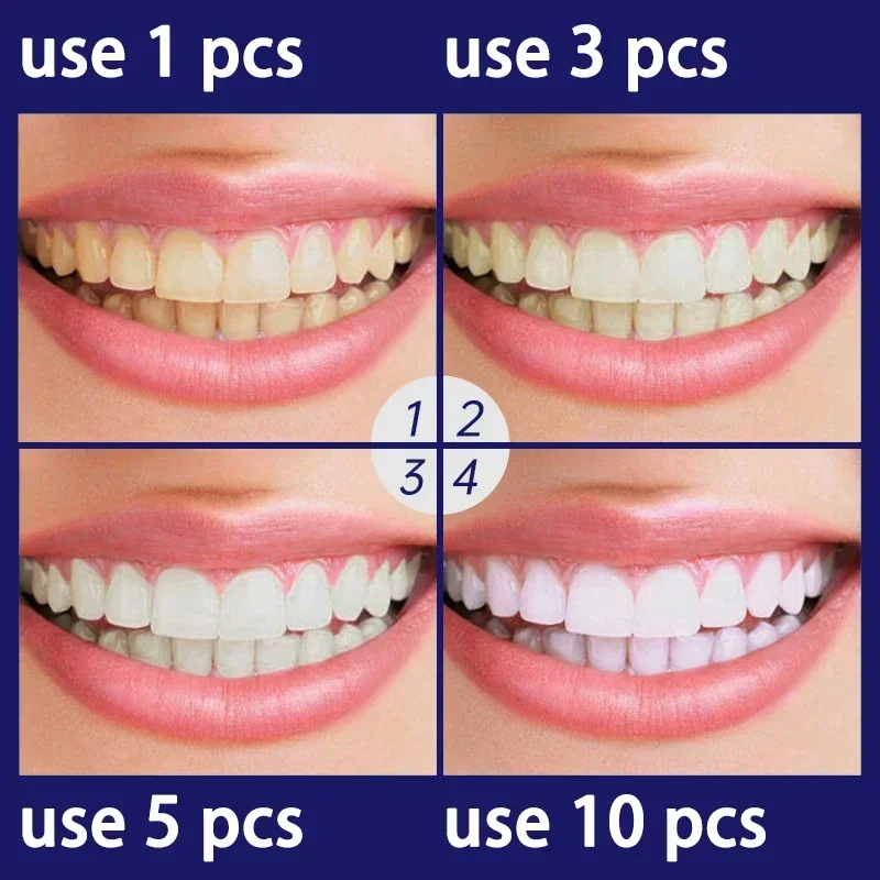 Teeth Whitening Essence Remove Plaque Stains Oral Hygiene Bleaching Products Cleansing Fresh Breath Dentistry Care Tools