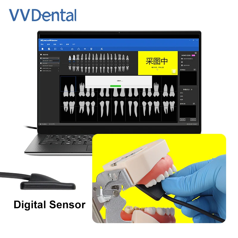 VV Dental Portable X-ray Sensor Hand-held Equipped With USB Connect for Instant Image Display High-Frequency Intraoral Imaging