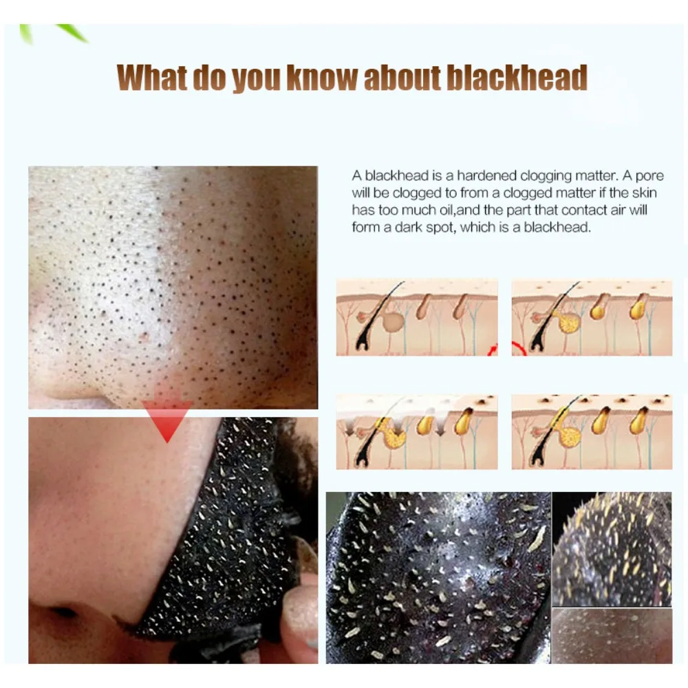 New Acne Treatments Black Head Remover Mask Peel Off Black Dots Black Face Mask Shrink Pores Skin Care Facial Mask Mud