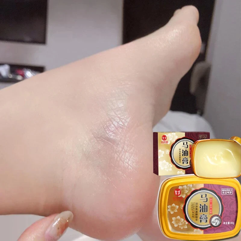 

3PCS Horse Oil Chinese 80g Oil Anti-Dryin Crack Foot Cream Heel Cracked Repair Cream Removal Dead Skin Hand Feet Care for Family