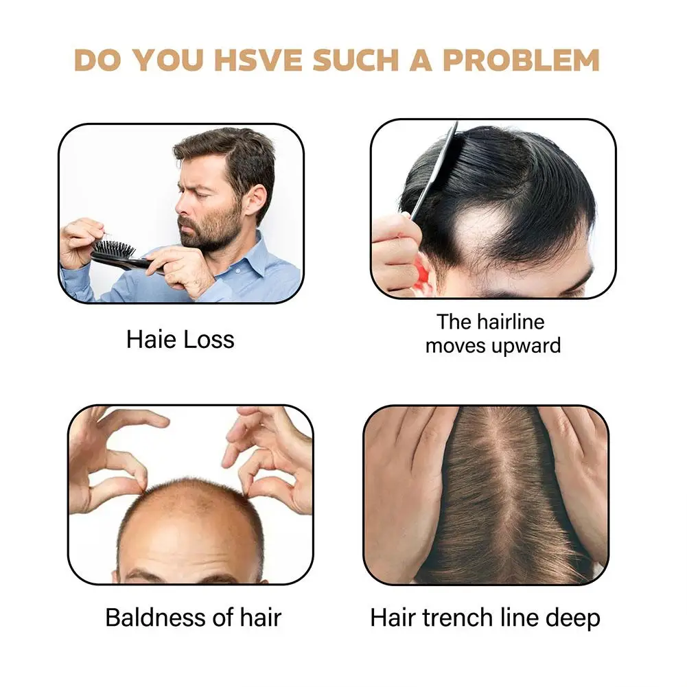 شامبو منشط الجذر، بلسم إعادة نمو الشعر الرمادي، صابون شامبو لتقوية الشعر من أجل لهاي ناعم وقوي Z4R9 #4