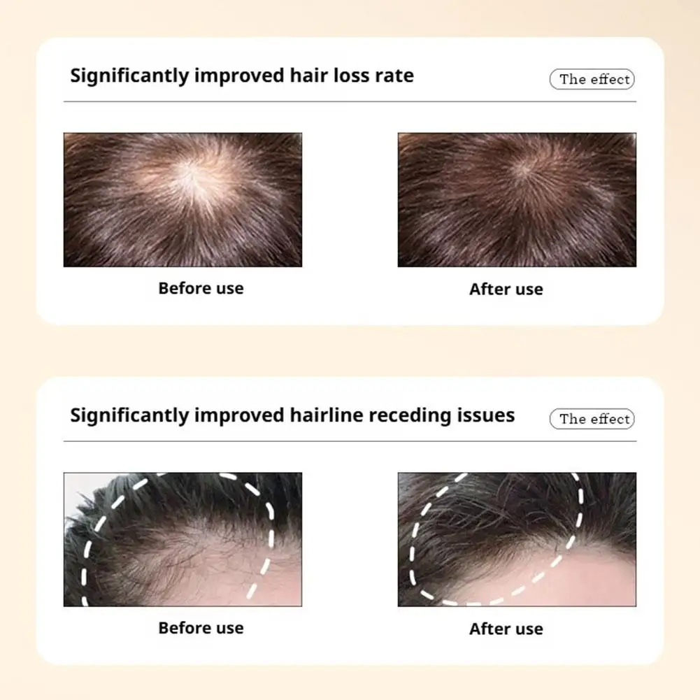 شامبو بوليغونوم مالتيفلوروم الزنجبيل المضاد لتساقط الشعر، تجديد سريع للشعر، مضاد للقشرة، شامبو للتحكم في الزيت 200 جرام