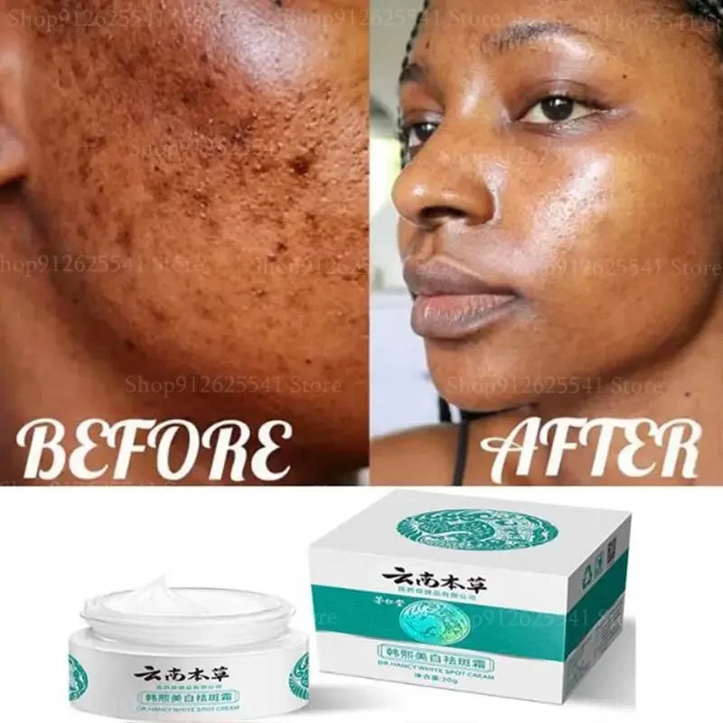 20g Herbal Whitening Freckle Removal Cream Nourishing Moisturizing Brightening Remove Spots and Acne Black Heads Whitening Skin