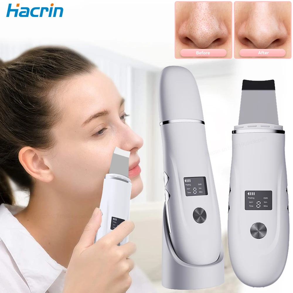 Rimozione di comedone Elettrico Pore Viso Cleaner Brufolo Acne Rimozione di punti neri Punto nero Rimuovi Peeling ad ultrasuoni Rimozione di punti neri