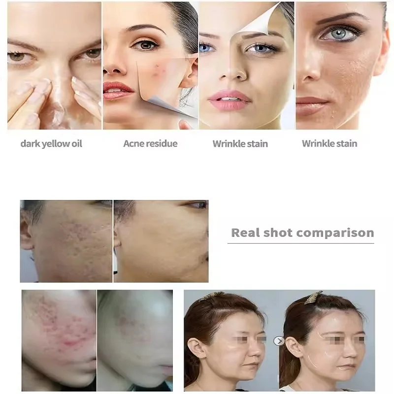 Multifunctional 7 in 1 Facial Cleanser Microdermabrasion Vacuum Spa Equipment Deep Cleanses Hydrates Skin