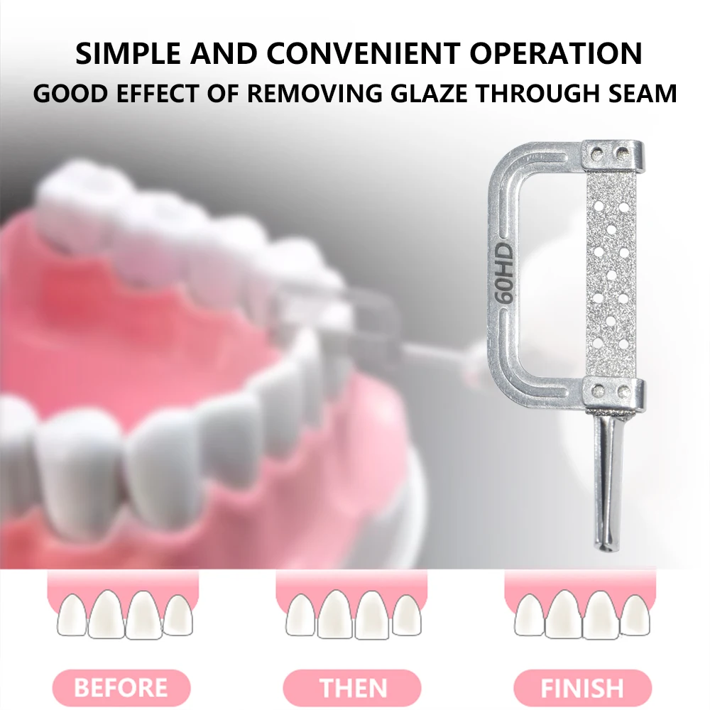 MBM Dentale Ortodontico Interproximale Smalto Riduzione IPR Sistema di Spellatura Alternativa con Manipolo contrangolo 4:1