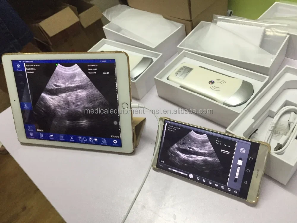 New & Innovative Wireless Probe Type Ultrasound Machine/High Tech Ultrasound Wireless Ultrasound