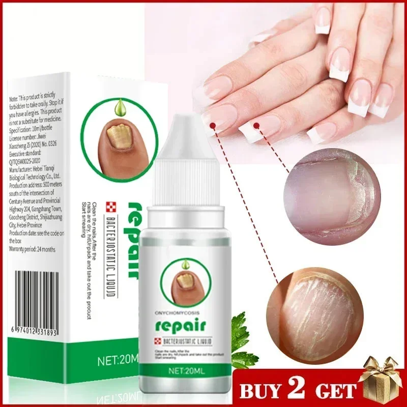 Fungal Nail Treatment Feet Care Essence Nail Foot Whitening Toe Nail Fungus Removal Gel Anti Infection Paronychia Onychomycosis