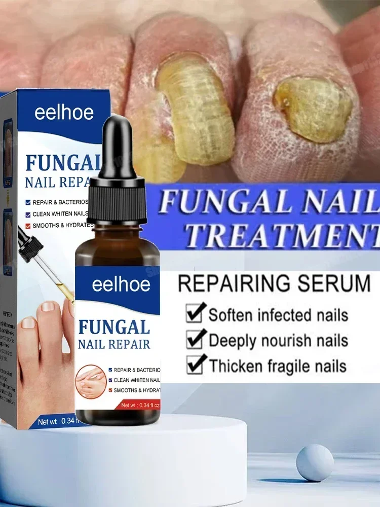 ネイル ファンガス トリートメント エッセンシャル オイル - 7日間で修復