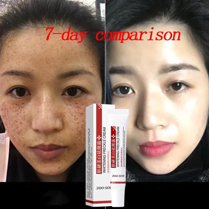 Whitening & Spot Removing Cream Face Melasma Melanin Brightening Dark Skin Face Care Moisturizing Product Korean Skin Care