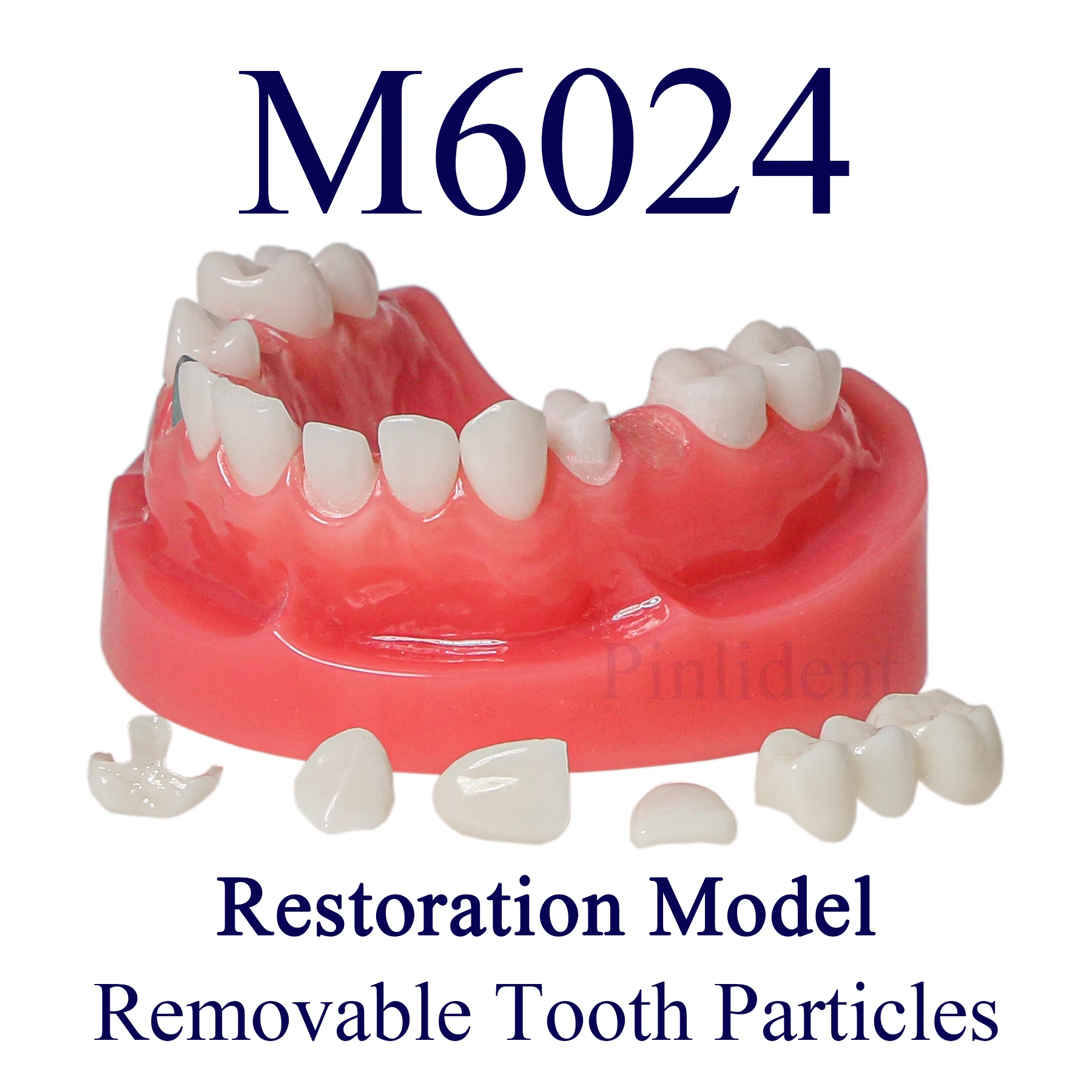 Dental Restoration Teeth Implant Model Implant Restoration Orthodontic Restoration Model With Stake Core Bridge M6024