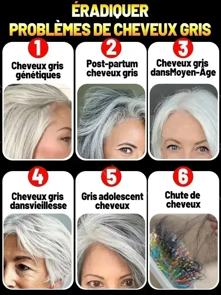 Turn white hair into black hair, remove gray hair in 7 days and restore natural and healthy hair color