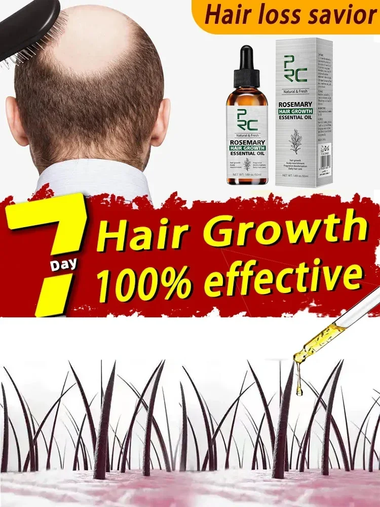 

Ginger Anti Hair Loss Serum for Men Women - Natural Hair Fast Growing Products with Rosemary Oil, Essential Oils