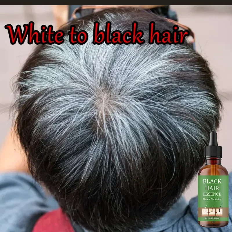 White Hair Care - Grey hair essence Serum White hair treatment essence quickly turns white air into black repairs natural