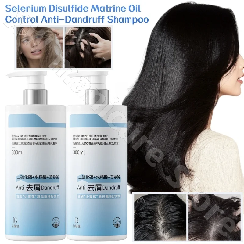 

Selenium Disulfide Matrine Oil Control Refreshing Shampoo 300ml Oil Control Fluffy Deep Cleansing Nourishing and Smoothing