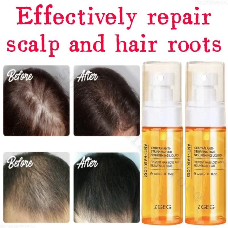 ZGEG Hair Restoring Liquid Softens Hair Refreshes and Fluffs It Nourishes Damaged Hair Follicles and PromotesGrowth 60ml