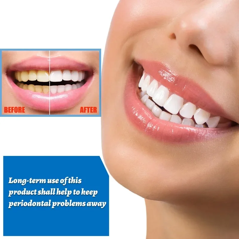 Teeth Whitening Essence toothpaste Remove yellow Stains Coffee Plaque Deep Cleaning Dental Oral Hygiene Fresh Breath Tooth Care