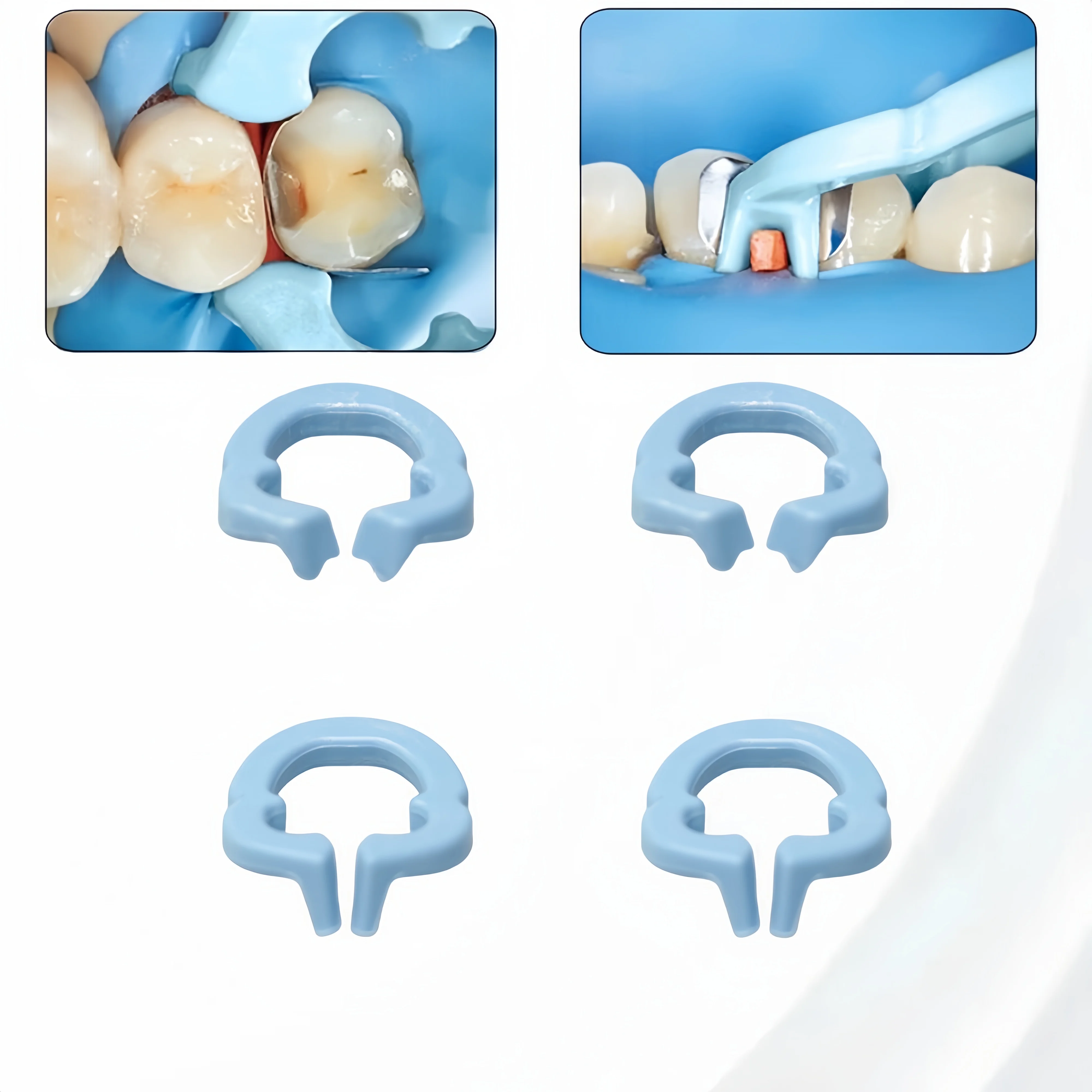 

4 шт. автоклавируемые зажимы для стоматологических матриц-кольца из металлической смолы для секционных контурных матриц и реставрационных процедур