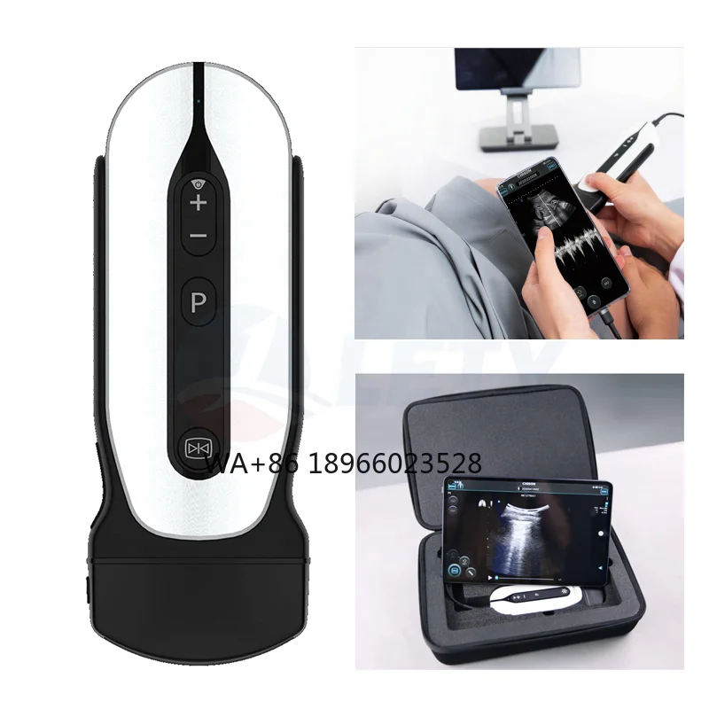 portable usb ultrasound handheld device Low cost intelligent pocket ultrasound