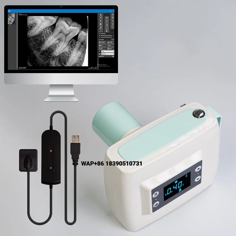 Mobile handheld X-ray machine, portable 60KV 2mA 0.7mm compact focusing digital high frequency veterinary and oral imagin