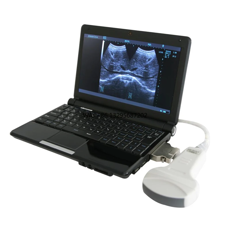 

Medical Ultrasound Veterinary Instruments 3d 4d Color Doppler Ultrasound Echocardiography Machine Ultrasound USG