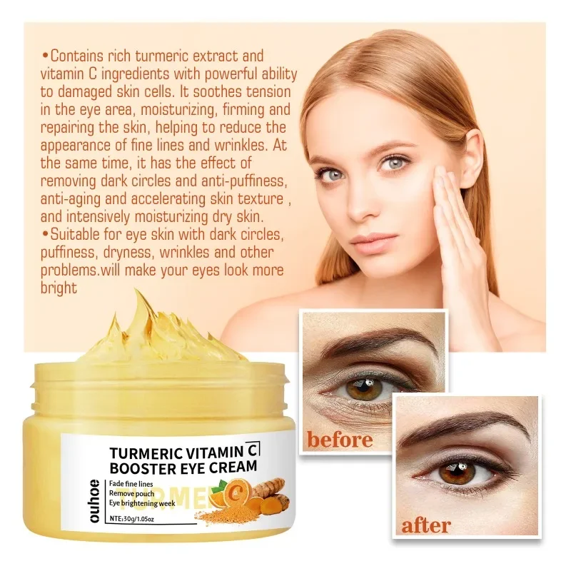 

Sdottor New Turmeric Vitamin C Repair Eye Cream Reduce Eye Bags remove Dark Circles Improve Fine Lines whitening Moisturizing fi