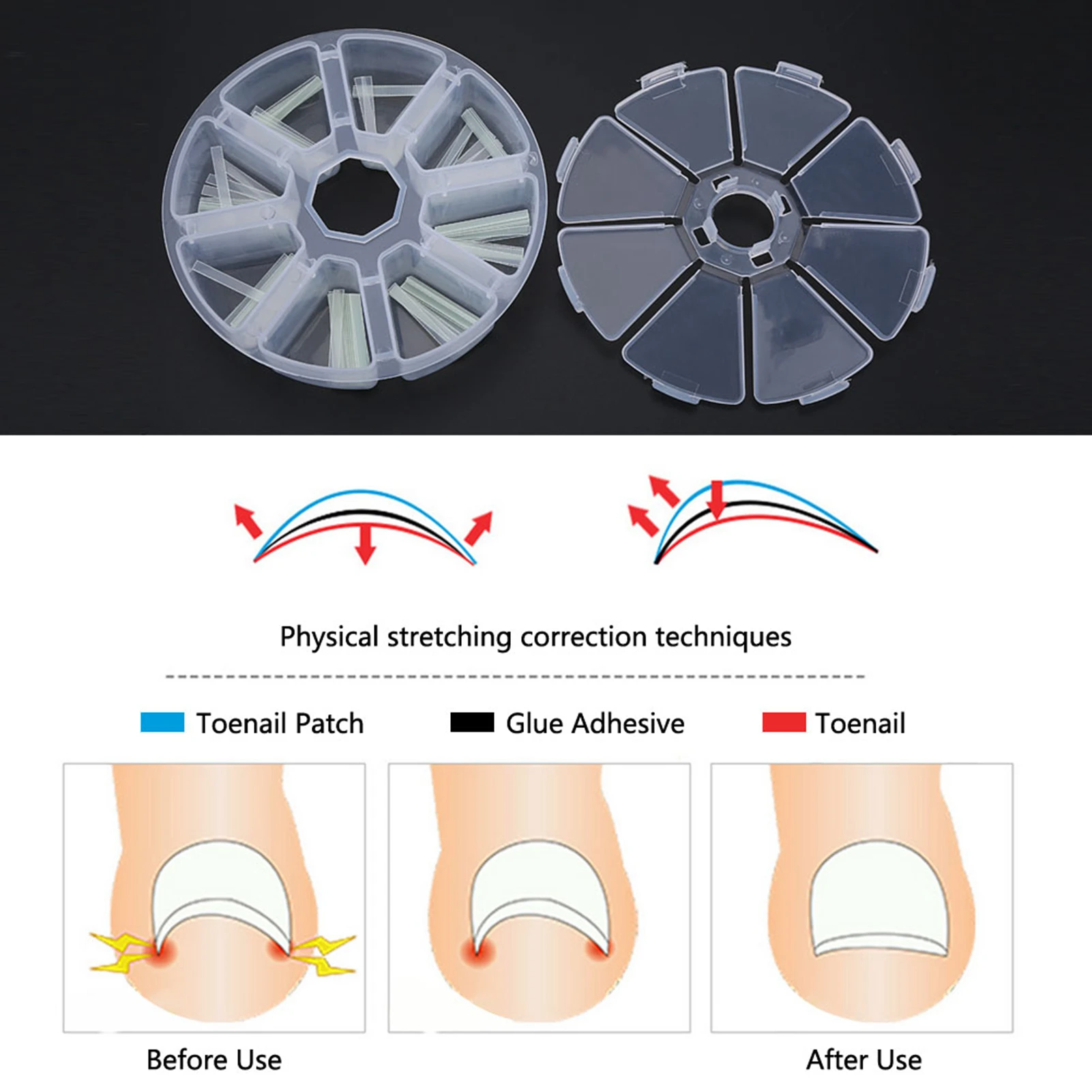 120 pièces/boîte autocollant incarné outil de soin des pieds pédicure incarné ongle redressage pince orteil autocollant pour ongles Patch outil de Correction