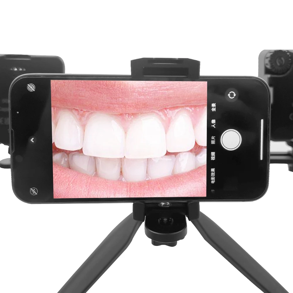 Luce per fotografia dentale Lampada di riempimento orale a LED intraorale Lampada dentale Attrezzatura Trattamento per dentisti Torcia fotografica mobile