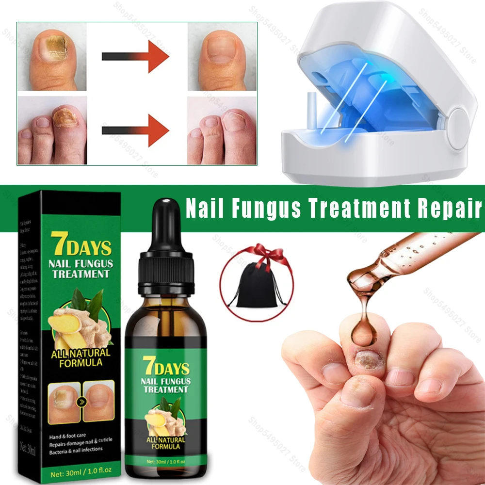 30ml Fungal Nail Treatment Essence Oil Nail Fungus Laser Device Repair Toenail Fingernail Treatment Onychomycosis with Mushrooms