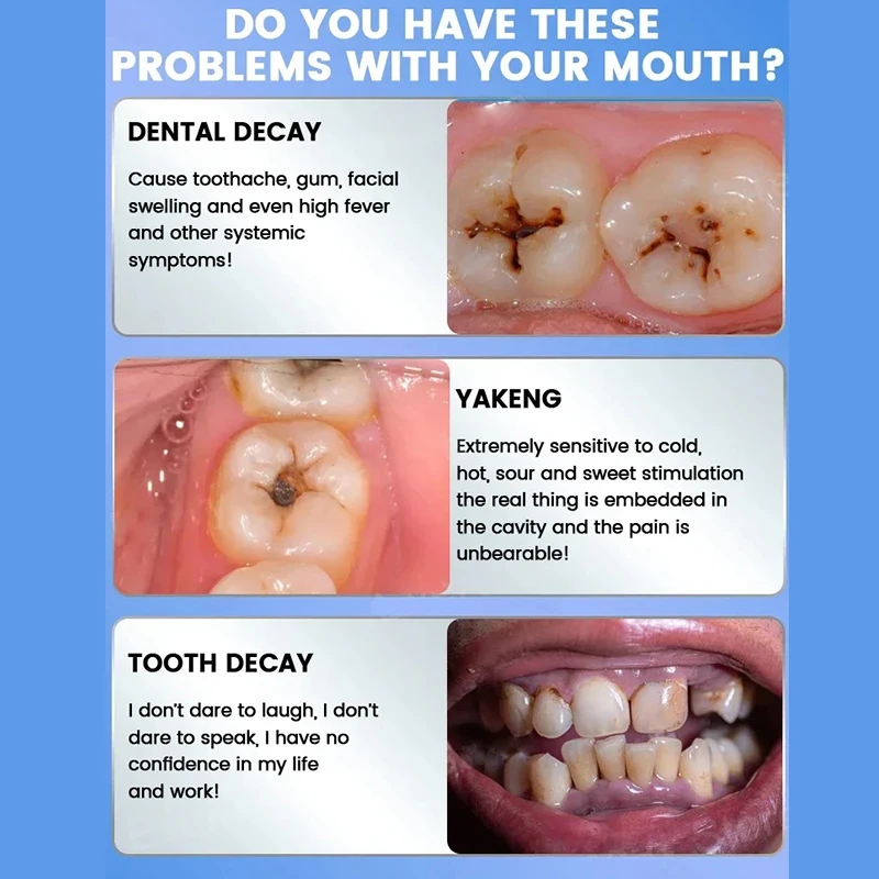 Probióticos Creme Dental Eficaz, Reparação do dente ruim deteriorado, Clareamento dos dentes, Cuidado da respiração fresca