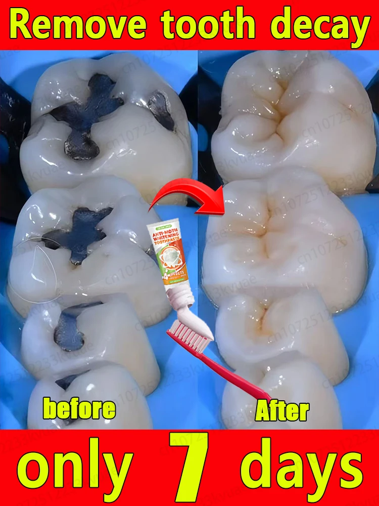 O creme dental reparador de cáries resolveu os problemas de cárie dentária e dor de dente para dezenas de milhares de pessoas.