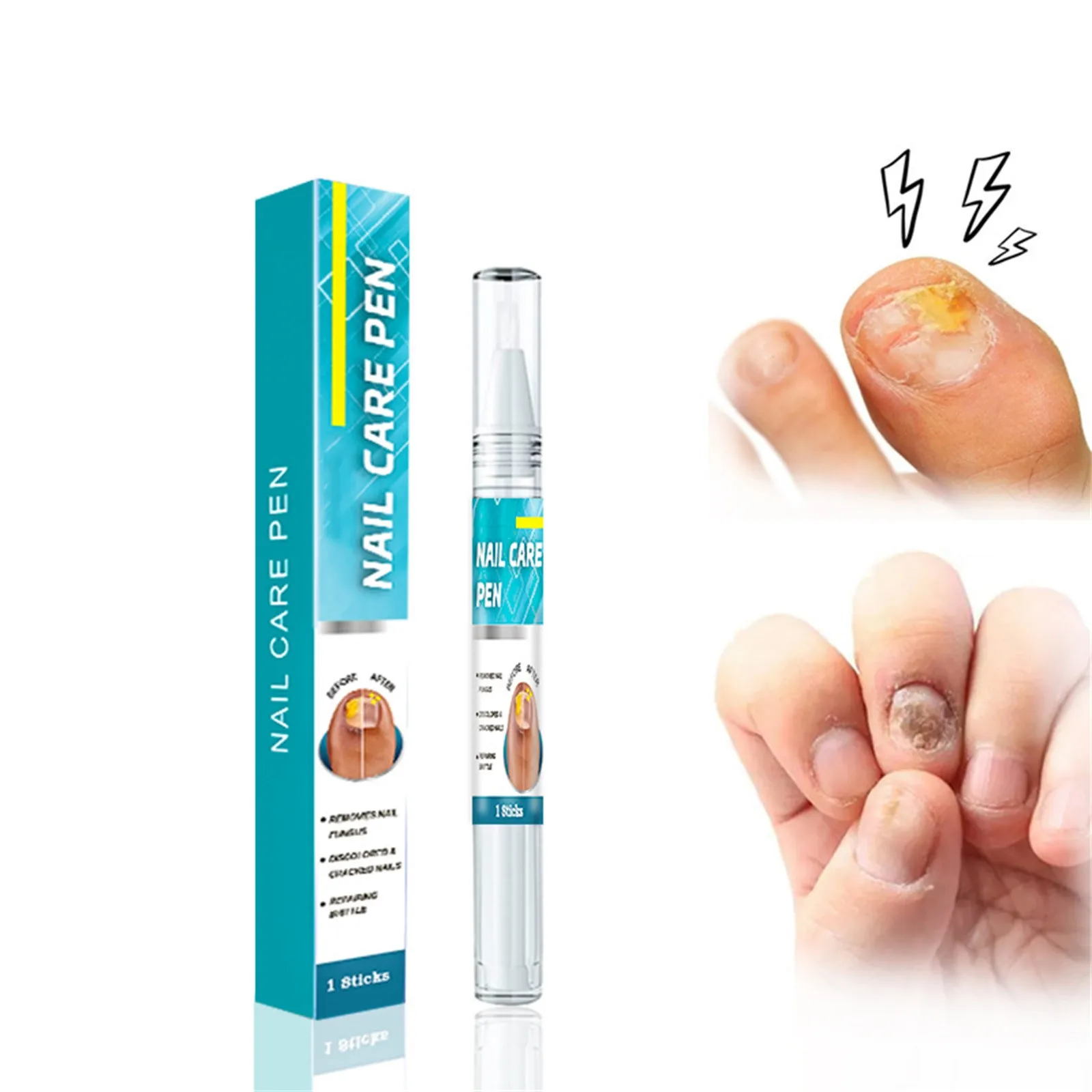 Toenail Fungus Care, FastActing Nail Care Liquid For Fungus Under & Around Restores The Healthy Appearance Of Nails 5ml