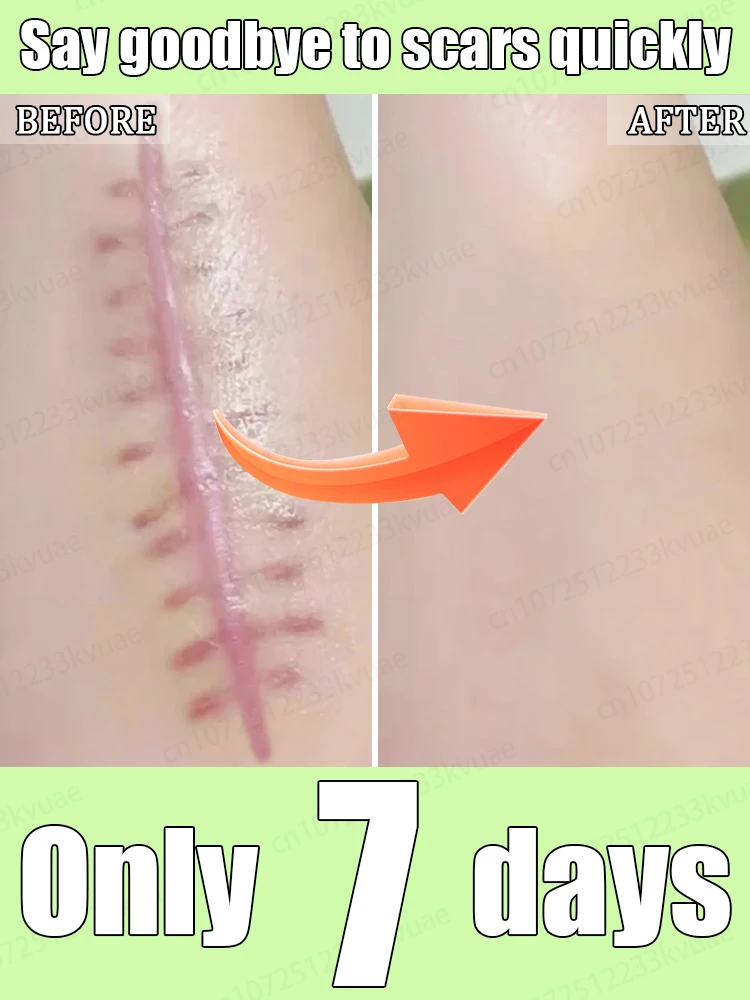 

ᴿᵉᵐᵒᵛᵉˢ ᵃˡˡ ᵗʸᵖᵉˢ ᵒᶠ ˢᶜᵃʳˢ